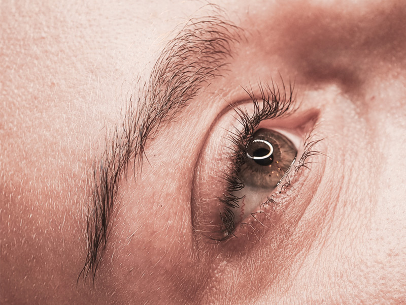 Augenbrauen und Wimpern - Vorher